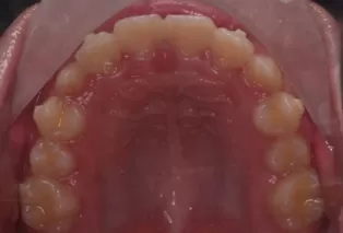 Intraoral photos